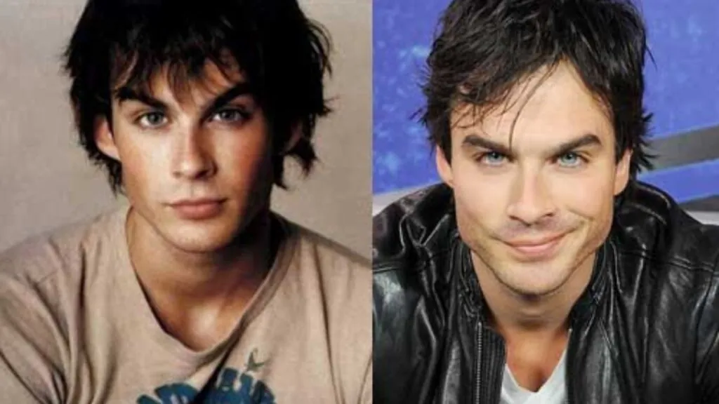 Ian Somerhalder Plastic Surgery Before And After, A Look At The Vampire ...