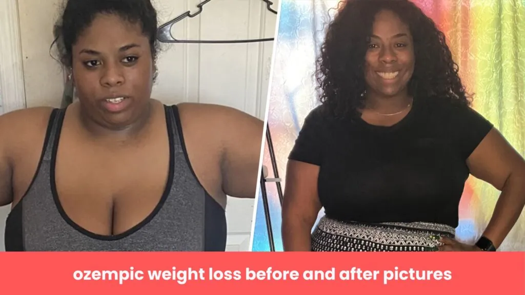 ozempic weight loss before and after pictures