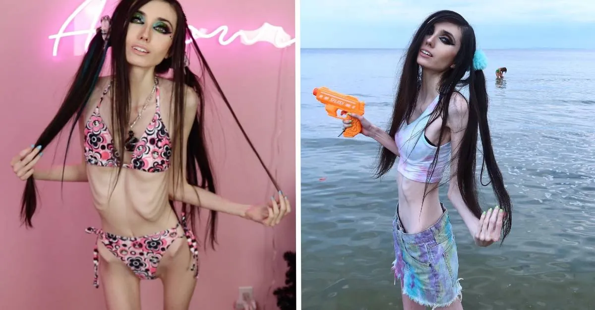 Eugenia-Cooney-before-and-after