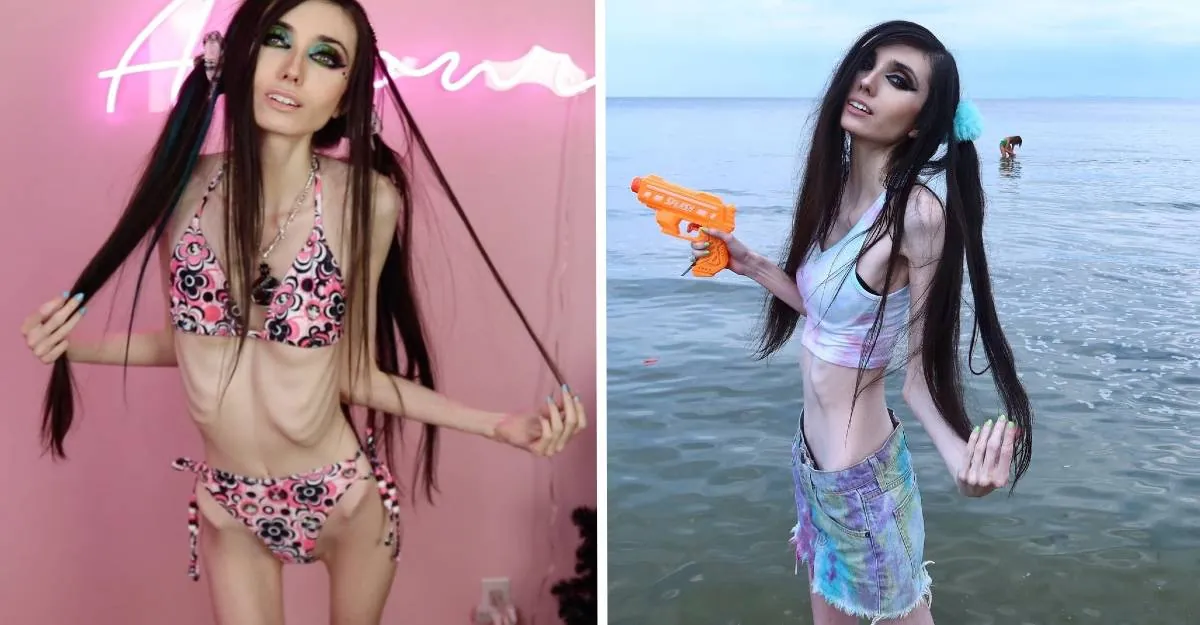 Eugenia Cooney Before And After Anorexia Know More About Her Body