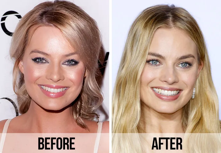 Did Margot Robbie Have A Nose Job? 
