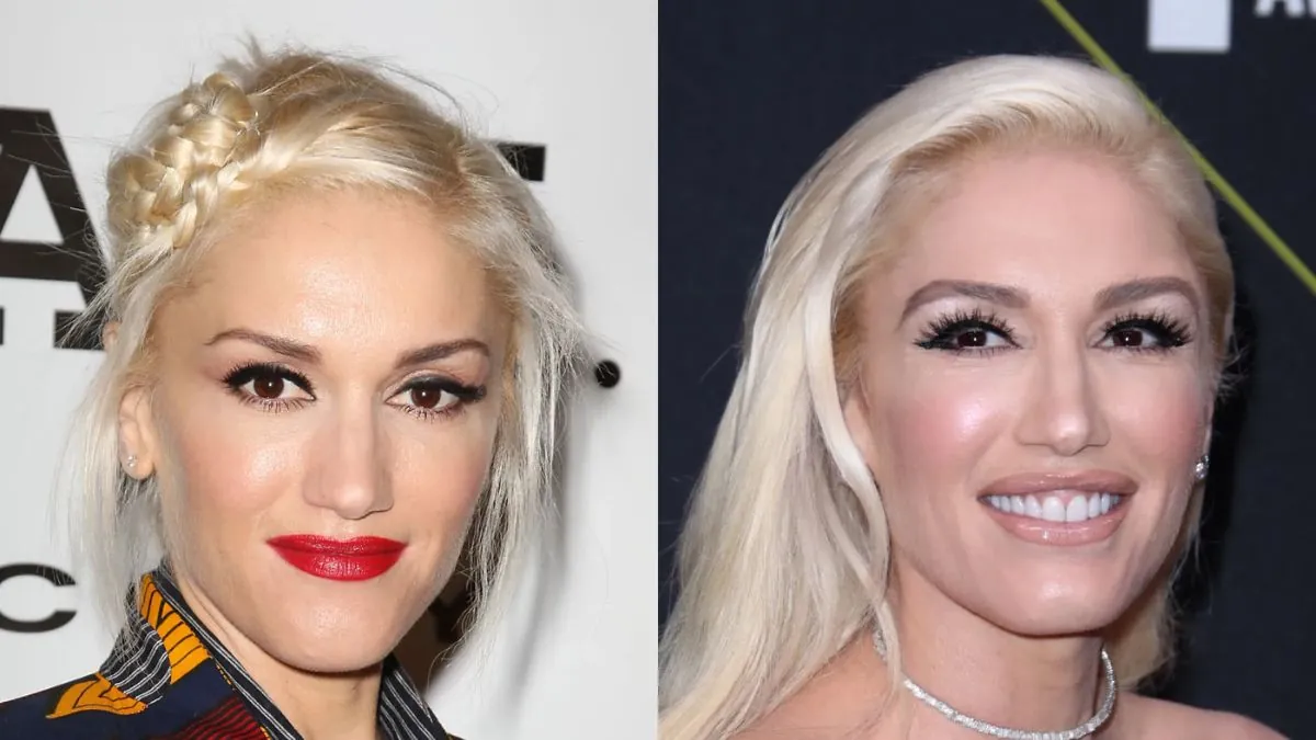 Did Gwen Stefani Get Plastic Surgery