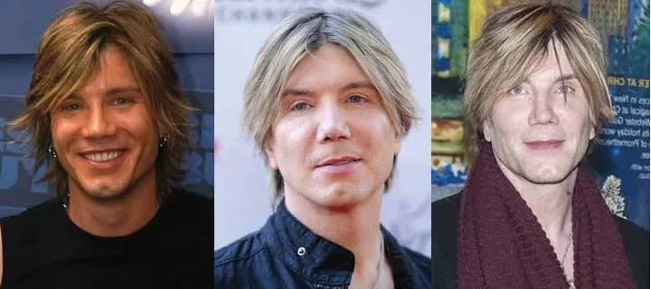 John Rzeznik Before And After Picture.