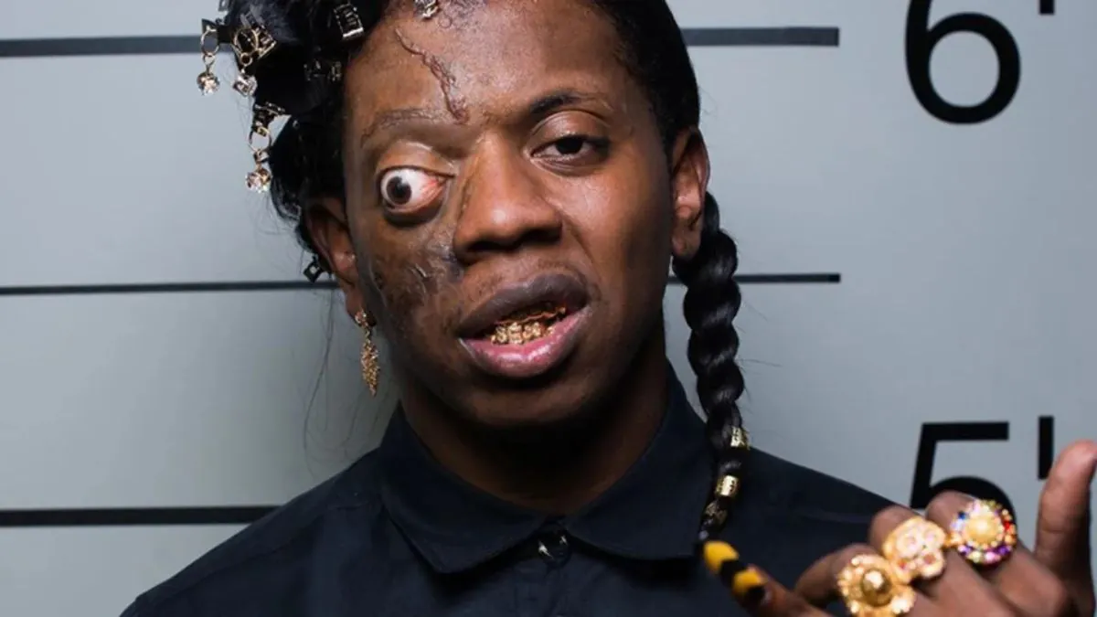 What Happened To Trinidad James Eye