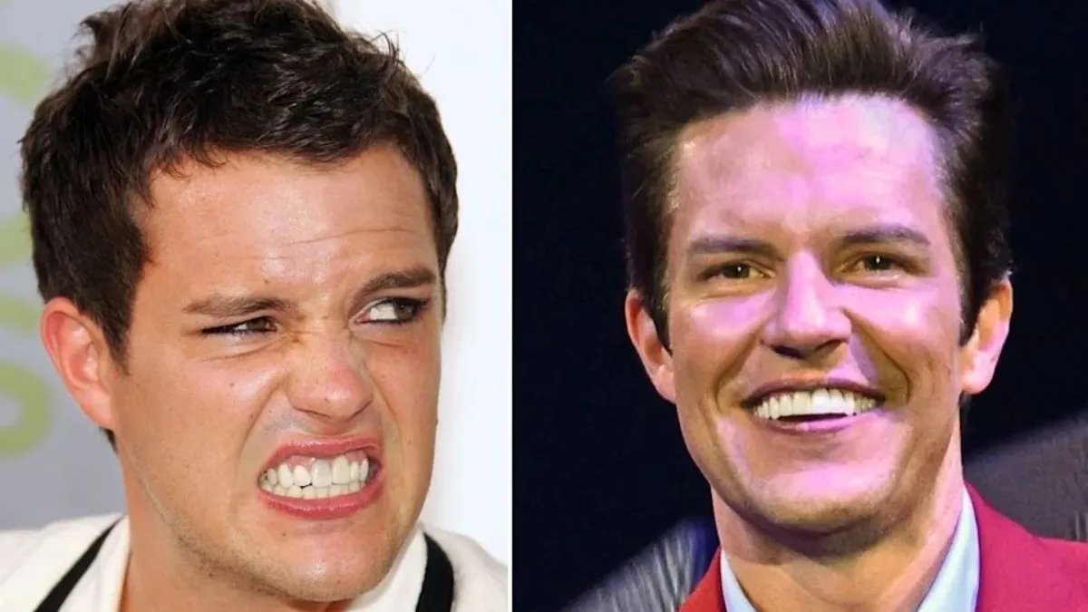 Brandon Flowers Teeth What Has He Done