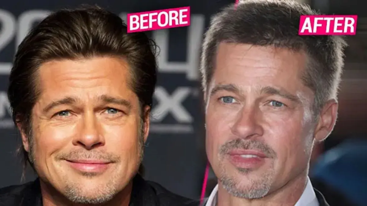 Unmasking the Rumors: A Deep Dive into Brad Pitt Plastic Surgery in 2023