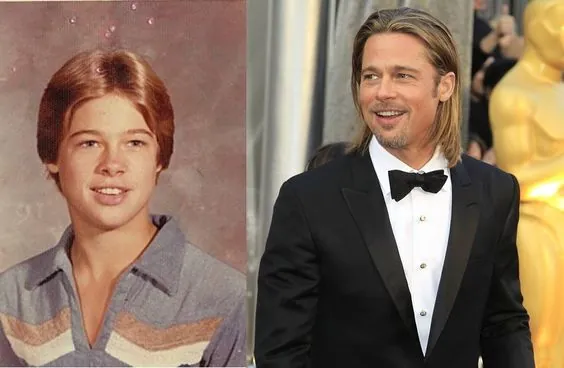Liposuction on Brad Pitt